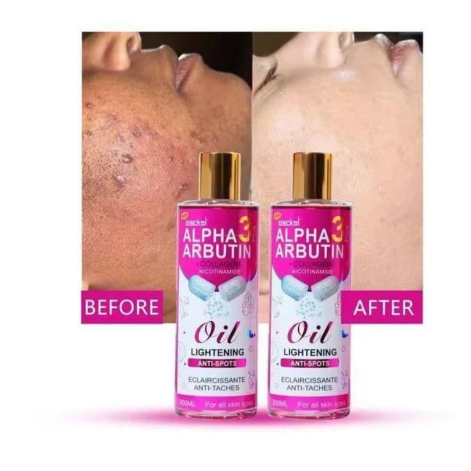 Arbutin 3 plus Lighting Anti-Spot Body Corrector Oil 300ml